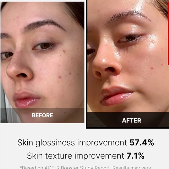 NWT 100 % authentic medicube device AG-R Booster H comes with 3 free samples - Picture 11 of 14